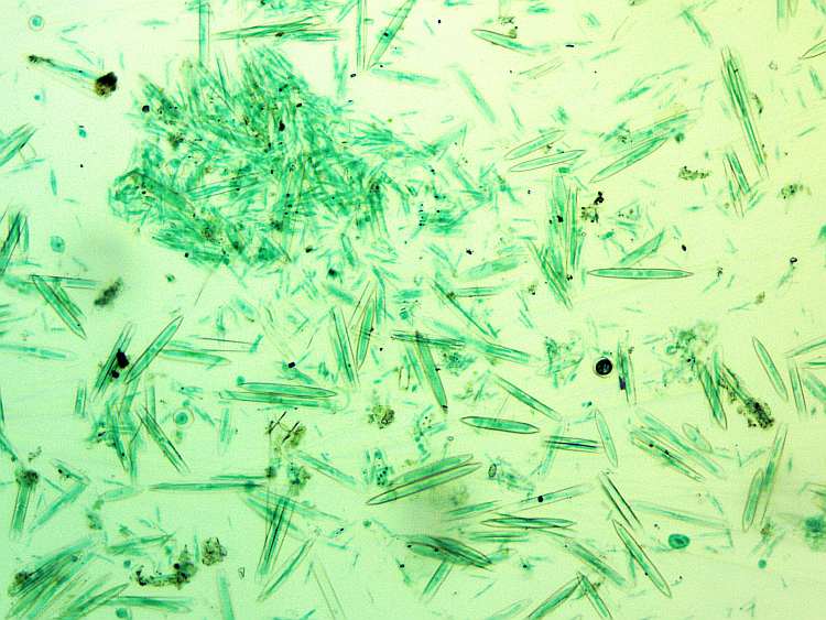 Les diatomées (250X) sont un type de micro-algues. Plus de 100K espèces différentes existent. Foto: Kevin Doolittle